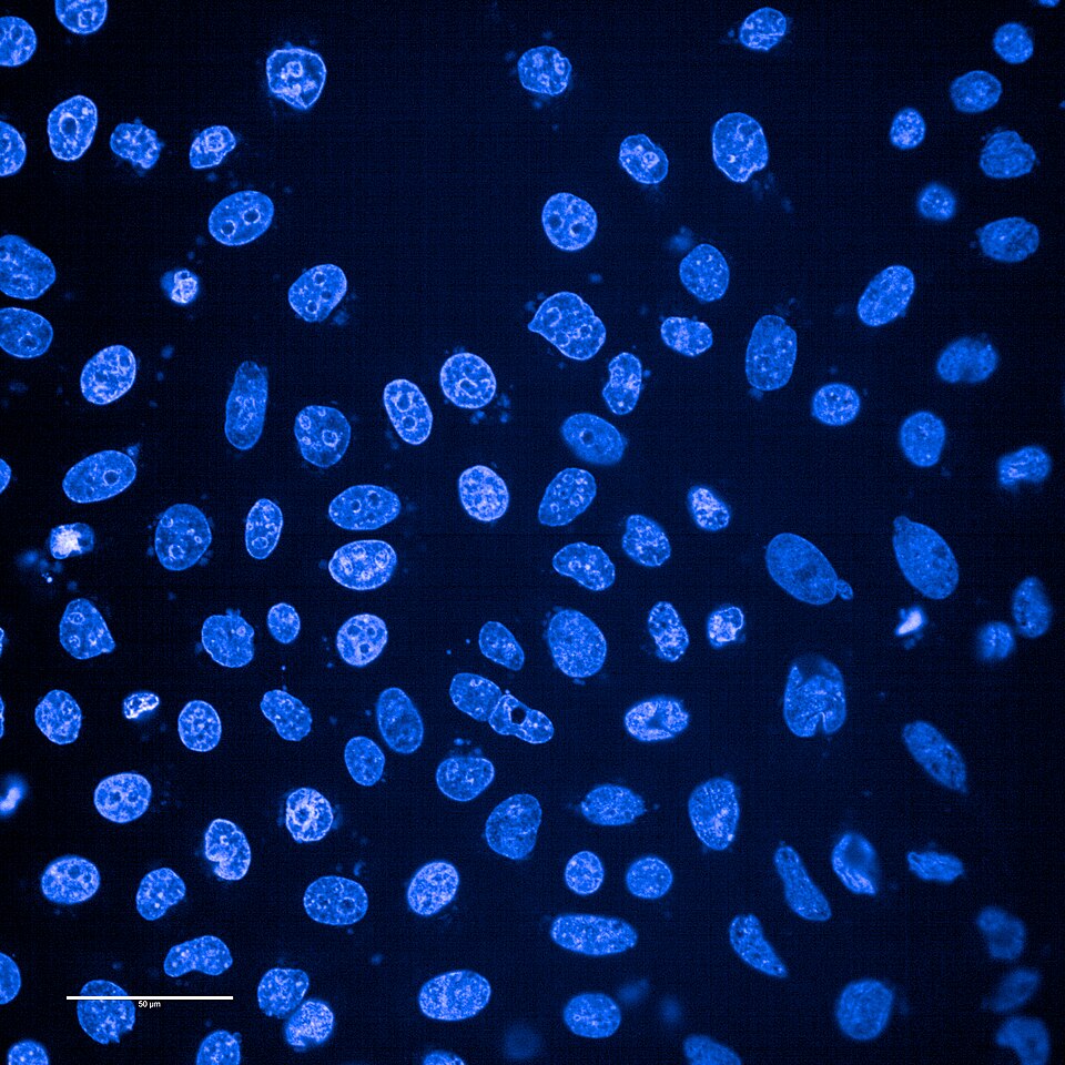 Des milliers de noyaux de cellules HeLa colorés au DAPI — visualisation de la lignée cellulaire qui a mené au vaccin contre le papillomavirus