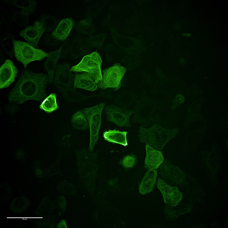 Réseau de microtubules d'une cellule HeLa en fluorescence verte — structure interne de la cellule immortelle d'Henrietta Lacks